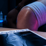 chondropathie stade 3 genou traitement radiographie bandage
