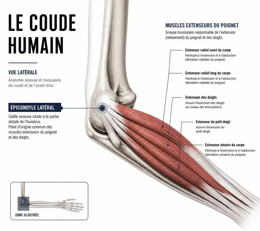 Schéma anatomique du coude et muscles impliqués dans l'épicondylite